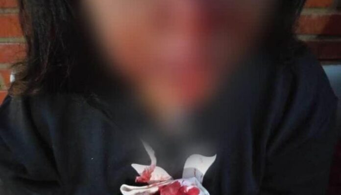 mulher-agredida-dourados-750x430-1 (1)